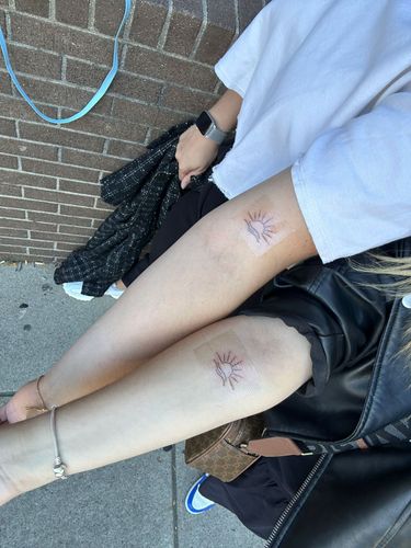 A person sits with their knees and arms showing scrapes and scabs from an injury.
